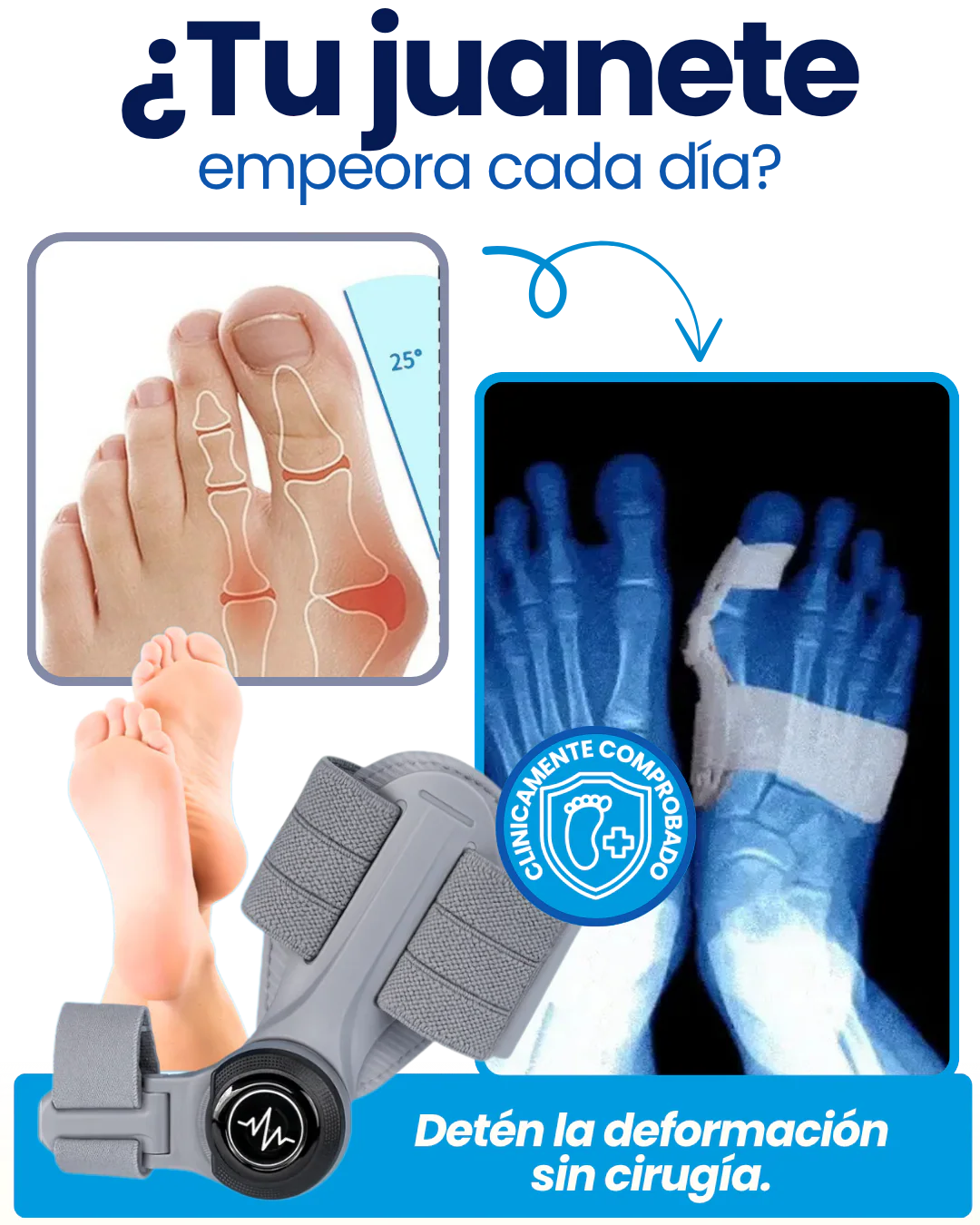Corrector De Juanetes. OFERTA 2x1