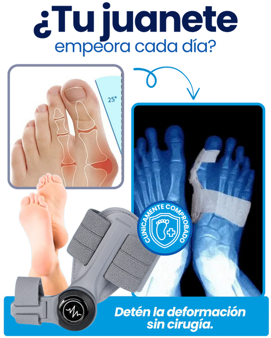 Corrector De Juanetes. OFERTA 2x1