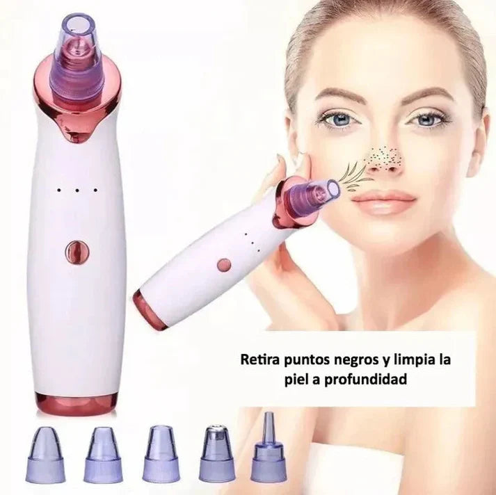 Extractor De Puntos Negros.