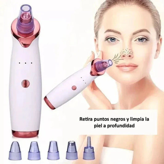 Extractor De Puntos Negros.